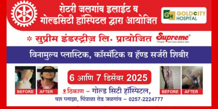 रोटरीतर्फे ‘प्लास्टिक, कॉस्मेटिक व हँड सर्जरी’ शिबिर; गरजू रुग्णांना मिळणार मोफत उपचार!